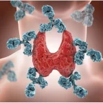 Understanding and Managing Autoimmune Diseases